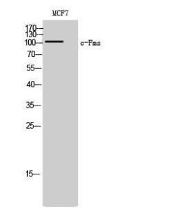 Western blot analysis of MCF7 cells using Anti-M-CSF Receptor Antibody