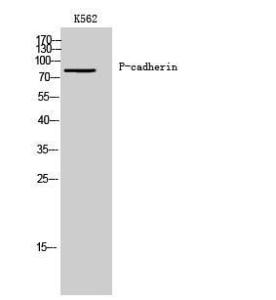 Western blot analysis of K562 cells using Anti-CDH3 Antibody