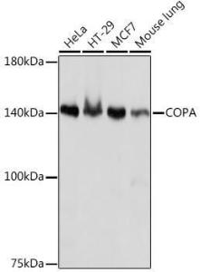 Western blot analysis of extracts of various cell lines, using Anti-alpha COP I/COPA Antibody [ARC2215] (A307527) at 1:1,000 dilution