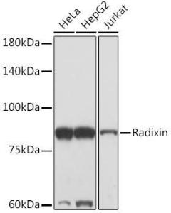 Western blot analysis of extracts of various cell lines, using Anti-Radixin / RDX Antibody [ARC2277] (A308483) at 1:1,000 dilution. The secondary antibody was Goat Anti-Rabbit IgG H&L Antibody (HRP) at 1:10,000 dilution.