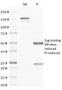 SDS-PAGE analysis of Anti-Factor XIIIa Antibody [F13A1/1683] under non-reduced and reduced conditions; showing intact IgG and intact heavy and light chains, respectively. SDS-PAGE analysis confirms the integrity and purity of the antibody.