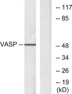 Western blot analysis of lysates from NIH/3T3 cells, treated with forskolin 40muM 30' using Anti-VASP Antibody The right hand lane represents a negative control, where the antibody is blocked by the immunising peptide