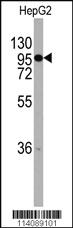 Anti-CHRD Rabbit Polyclonal Antibody