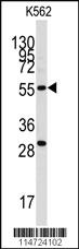 Anti-CLIC5 Rabbit Polyclonal Antibody