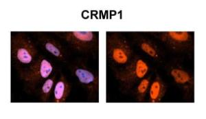 Anti-CRMP1 Rabbit Polyclonal Antibody