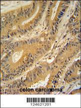 Anti-GNAT3 Rabbit Polyclonal Antibody