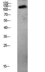 Western blot analysis of mouse liver lysate using Anti-CDH3 Antibody