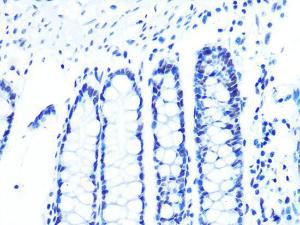 Anti-U2AF65 Rabbit Monoclonal Antibody [clone: ARC1029]