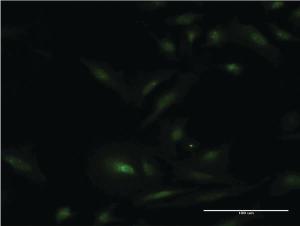 Anti-ESR1 Mouse Monoclonal Antibody [clone: 2F8]