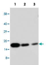 Anti-IL1B Rabbit Polyclonal Antibody