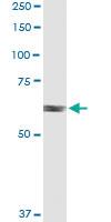 Anti-RARS Polyclonal Antibody Pair