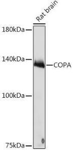 Western blot analysis of extracts of Rat brain, using Anti-alpha COP I/COPA Antibody [ARC2215] (A307527) at 1:1,000 dilution