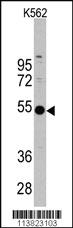 Anti-CIR1 Rabbit Polyclonal Antibody