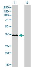 Anti-TEAD4 Mouse Monoclonal Antibody [clone: 5H3]