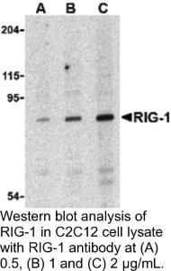 Anti-RIG-1 Rabbit Polyclonal Antibody