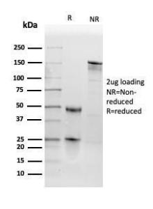 SDS-PAGE analysis of Anti-Thyroid Peroxidase Antibody [TPO/3698] under non-reduced and reduced conditions; showing intact IgG and intact heavy and light chains, respectively. SDS-PAGE analysis confirms the integrity and purity of the antibody.