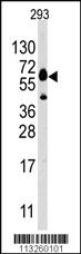 Anti-ZBTB7B Rabbit Polyclonal Antibody