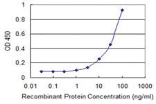 Anti-ESR1 Mouse Monoclonal Antibody [clone: 2F8]