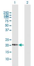 Anti-DHRS11 Rabbit Polyclonal Antibody