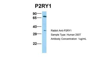 Anti-P2RY1 Rabbit Polyclonal Antibody