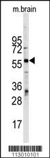 Anti-MPO Rabbit Polyclonal Antibody