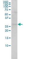 Anti-SH3BGR Mouse Monoclonal Antibody [clone: 3B7]