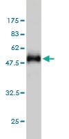 Anti-HYI Mouse Monoclonal Antibody [clone: 2A2]