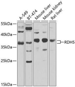 Anti-RDH5 Antibody (A10279)