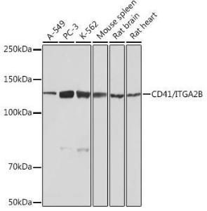 Western blot analysis of extracts of various cell lines, using Anti-CD41 Antibody [ARC0620] (A81216) at 1:1,000 dilution