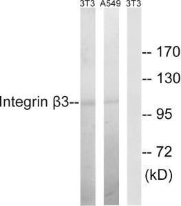 Western blot analysis of lysates from NIH/3T3 and A549 cells using Anti-Integrin beta3 Antibody. The right hand lane represents a negative control, where the antibody is blocked by the immunising peptide