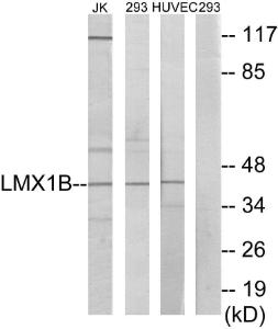 Western blot analysis of lysates from Jurkat, 293, and HUVEC cells using Anti-LMX1B Antibody. The right hand lane represents a negative control, where the antibody is blocked by the immunising peptide.