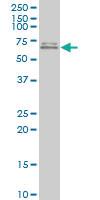 Anti-ESR2 Mouse Polyclonal Antibody