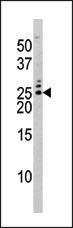 Anti-BAD Rabbit Polyclonal Antibody (Biotin)