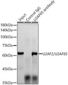 Anti-U2AF65 Rabbit Monoclonal Antibody [clone: ARC1029]