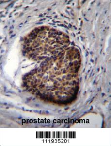 Anti-PSCA Rabbit Polyclonal Antibody