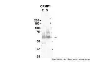 Anti-CRMP1 Rabbit Polyclonal Antibody