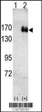 Anti-ERBB2 Rabbit Polyclonal Antibody