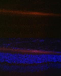 Immunofluorescence analysis of rat retina using Anti-RDH5 Antibody (A10279) at a dilution of 1:100 (40X lens). DAPI was used to stain the cell nuclei (blue)