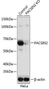 Western blot analysis of extracts from normal (control) and PACSIN2 knockout (KO) HeLa cells, using Anti-PACSIN2 Antibody (A308486) at 1:1000 dilution