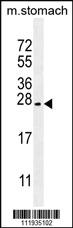 Anti-PSCA Rabbit Polyclonal Antibody