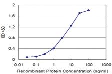 Anti-RCVRN Mouse Monoclonal Antibody [clone: 5A6]