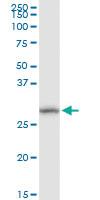 Anti-DHRS11 Rabbit Polyclonal Antibody