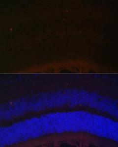 Immunofluorescence analysis of mouse retina using Anti-RDH5 Antibody (A10279) at a dilution of 1:100 (40X lens). DAPI was used to stain the cell nuclei (blue)