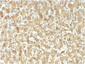 Anti-FABP1 antibody