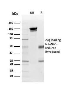 SDS-PAGE analysis of Anti-Myelin Basic Protein Antibody [MBP/4275] under non-reduced and reduced conditions; showing intact IgG and intact heavy and light chains, respectively. SDS-PAGE analysis confirms the integrity and purity of the Antibody