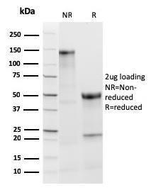 Anti-Thyroid Peroxidase antibody