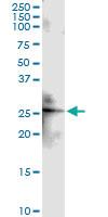 Anti-CLDN4 Rabbit Polyclonal Antibody