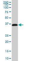 Anti-RP2 Mouse Monoclonal Antibody [clone: 1B4]