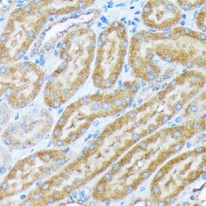 Immunohistochemistry analysis of paraffin-embedded mouse kidney using Anti-alpha COP I/COPA Antibody [ARC2215] (A307527) at a dilution of 1:100(40X lens). Perform microwave antigen retrieval with 10 mM Tris/EDTA buffer pH 9.0 before commencing with IHC staining protocol