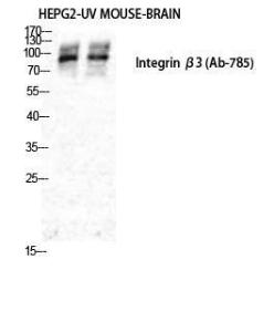 Western blot analysis of various cells using Anti-Integrin beta3 Antibody